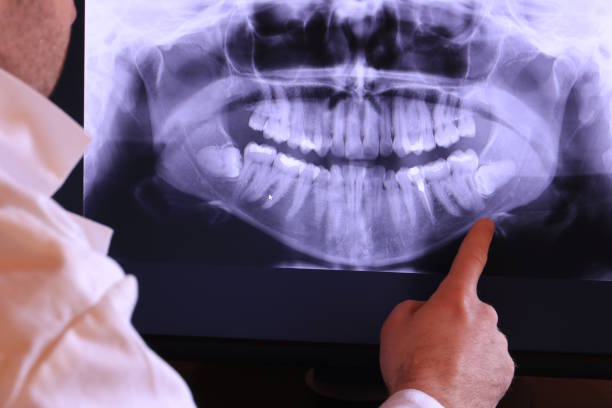 Best Emergency Root Canal Treatment in Valley Falls, SC