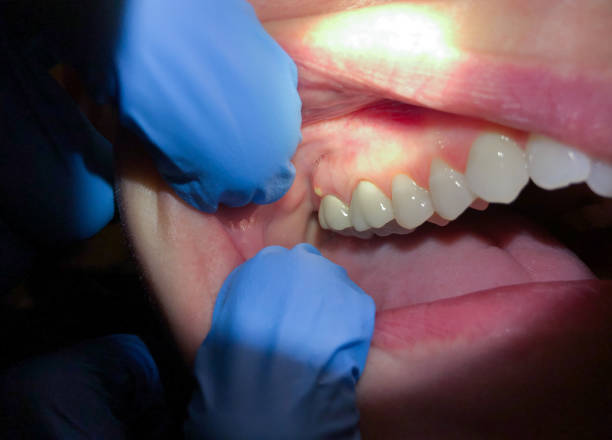 Best Walk-In Emergency Dentist in Valley Falls, SC